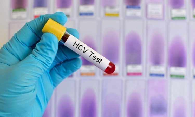 Začenja se brezplačno testiranje na hepatitis C