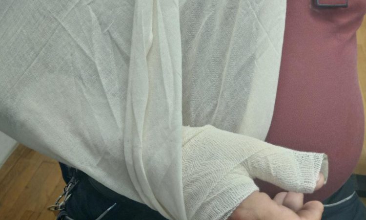 V romskem naselju Poganci poškodovan občinski redar