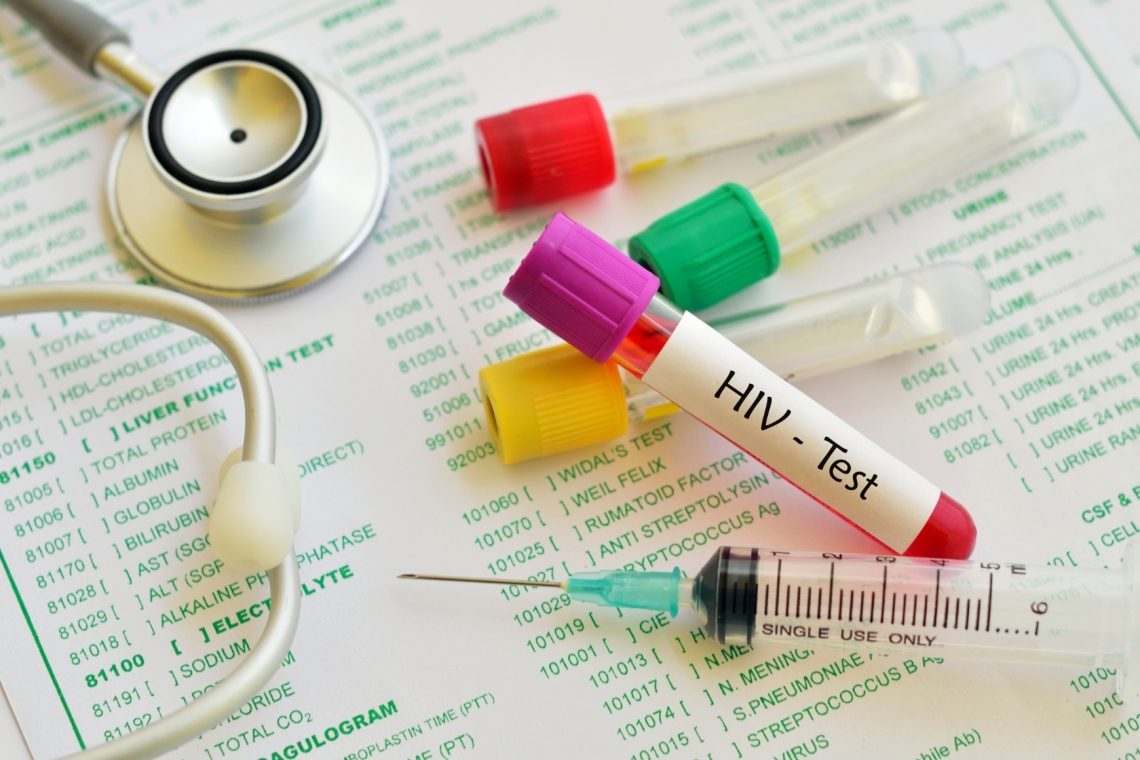 Cepiva proti covidu-19 ne vsebujejo HIV  